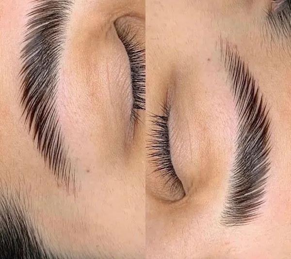 Eyebrow lift with thread 8