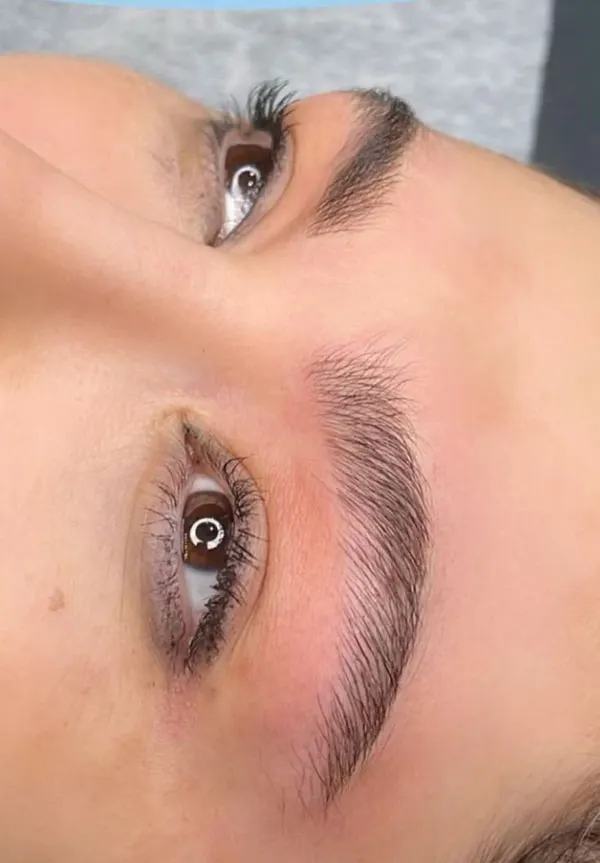 Eyebrow lift with thread 9