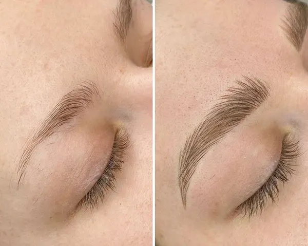 5 نکته مهم درباره تفاوت فیبروز و میکروبلیدینگ! 16 The Difference Between Phibrows and Microblading 12